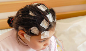 Electrodes